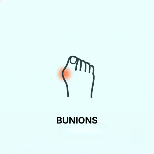 Bunions